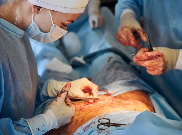 Umbilical Hernia Surgery